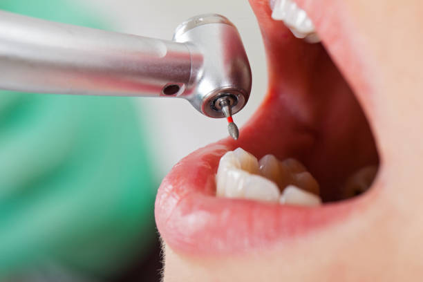 Best Emergency Dentist for Knocked-Out Tooth in Miami Gardens, FL